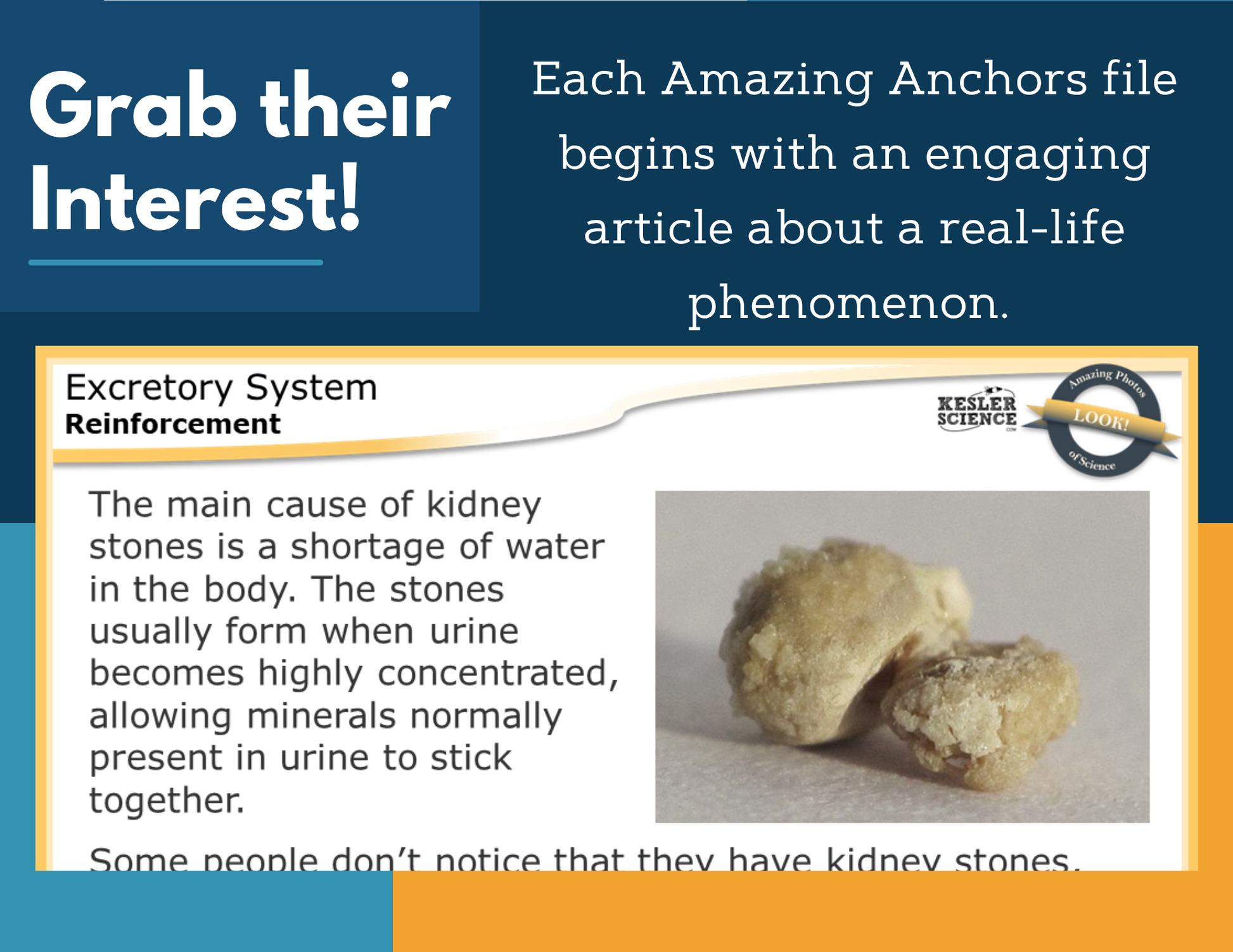 Amazing Anchors - Excretory System - MS 6-8