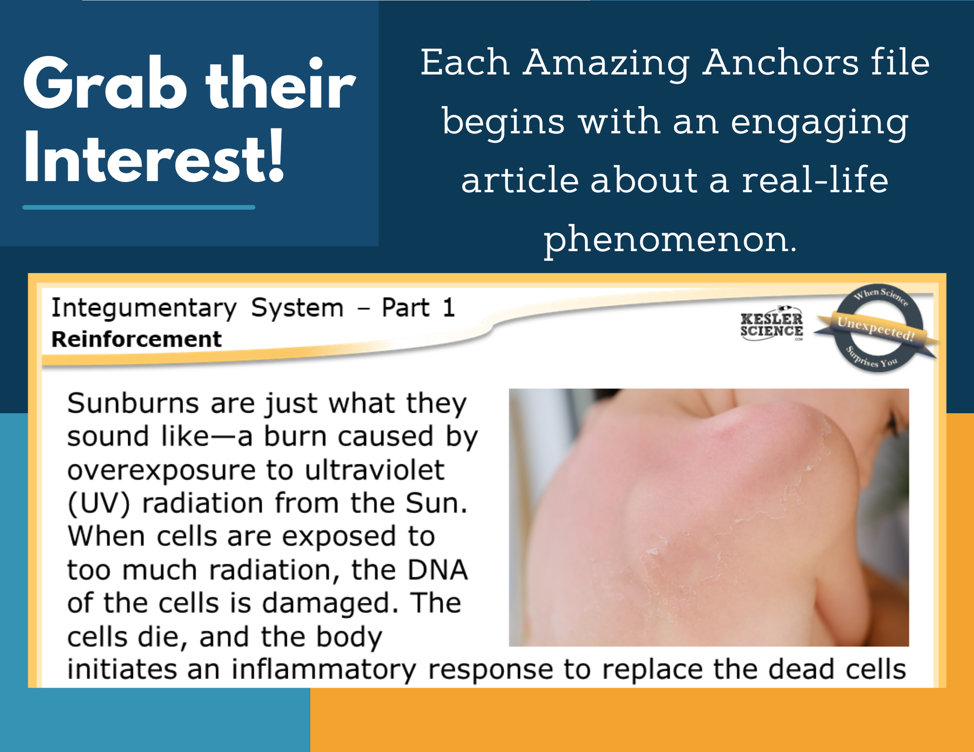 Amazing Anchors - Integumentary System - MS 6-8