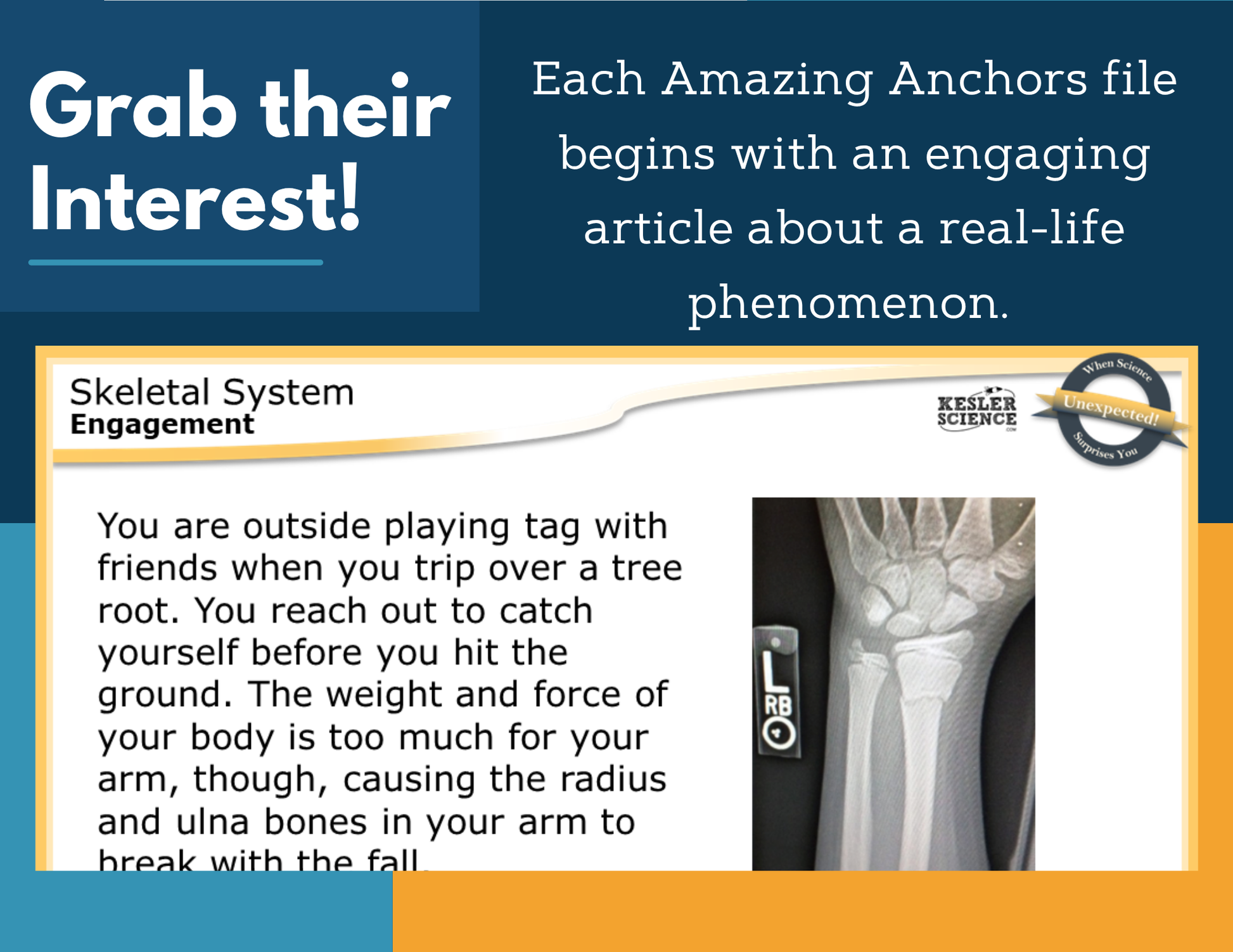 Amazing Anchors - Skeletal System - MS 6-8